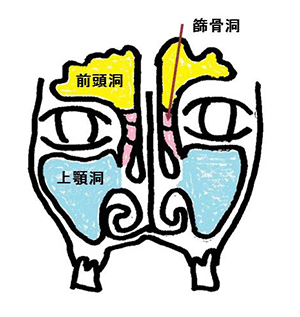 副鼻腔